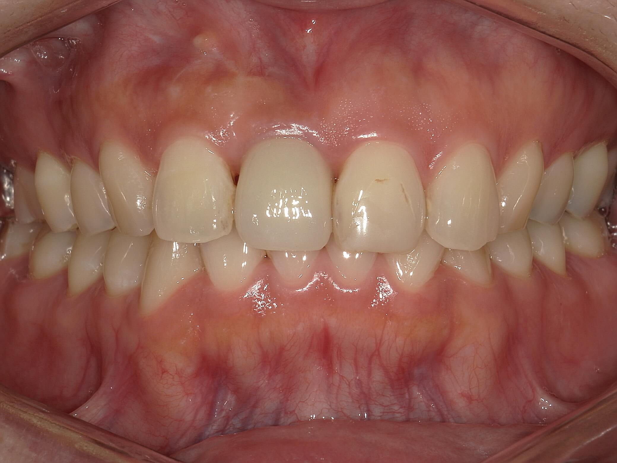 治療後の写真